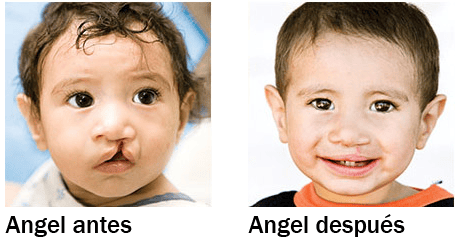 angel_before_after-with text