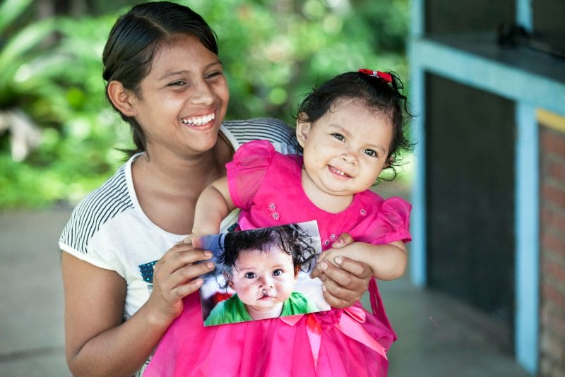 NIC_2015_Esteli_104_Valesca Gonzacez Lopez_After_
104 Valesca Gonzacez Lopez, UCL female 16 months old mom 18 years old. Operation Smile Mission at the Hospital San Juan De Dios in Esteli, Nicaragua. November 06-14, 2015. (Operation Smile Photo - Marc Ascher)